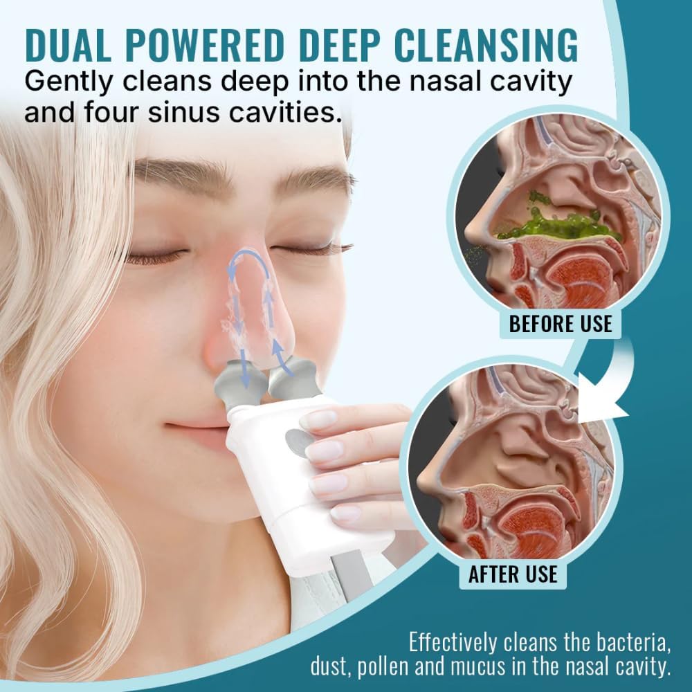SPA SCIENCES NasalFresh MD, Nasal Irrigation, Sinus Relief, 30 Saline Packs